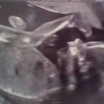 Woman sees ghost of dead mother in baby sonogram